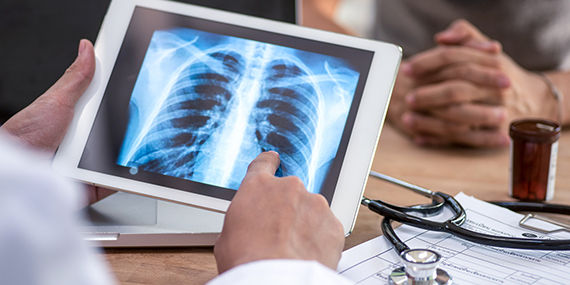 A doctor looks at the results of a lung health screening on a digital tablet